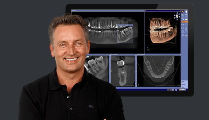 3D-Planung der Implantatversorgung