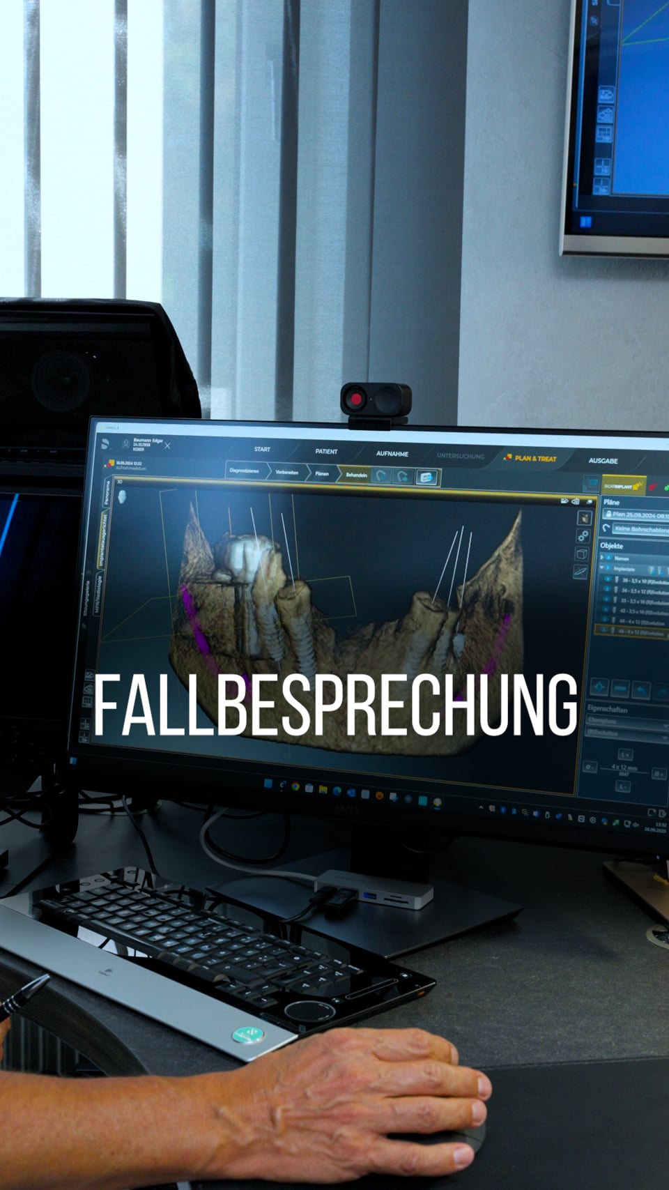 Fallbesprechung zum 48-Stunden-Konzept